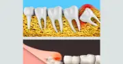 Wisdom Teeth in Your Twenties: Why They Cause Pain and When to See a Dentist